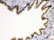 IHC testing of FFPE rat lung tissue with RAGE antibody. HIER: Boil the paraffin sections in pH 6, 10mM citrate buffer for 20 minutes and allow to cool prior to staining.