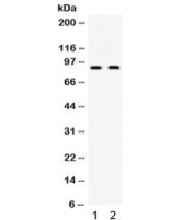 Western blot testing of 1) mouse testis and 2) human HeLa lysate with CIP2A antibody. Routinely observed at 90 kDa.