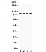 Western blot testing of 1) rat spleen, 2) rat thymus, 3) human placenta and 4) HeLa lysate with HDAC7 antibody. Expected/observed molecular weight ~103 kDa.