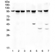 Western blot testing of 1) rat brain, 2) rat testis, 3) rat liver, 4) mouse liver, 5) mouse spleen, 6) mouse NIH3T3 and 7) human HeLa lysate with ALIX antibody. Expected/observed molecular weight ~96 kDa.