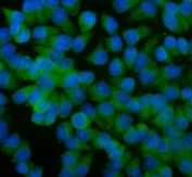 Immunofluorescent staining of FFPE human T-47D cells with ALIX antibody (green) and DAPI nuclear stain (blue). HIER: steam section in pH6 citrate buffer for 20 min.