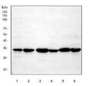 Western blot testing of 1) human U-87 MG, 2) human U-251, 3) rat brain, 4) rat C6, 5) mouse brain and 6) mouse Neuro-2a cell lysate using APH1A antibody.  Expected molecular weight: 27~29 kDa.