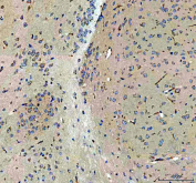 IHC testing of FFPE mouse brain tissue with Otoferlin antibody. HIER: Boil the paraffin sections in pH 8 EDTA buffer for 20 minutes and allow to cool prior to staining.