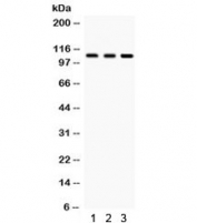 Western blot testing of 1) rat testis, 2) rat brain and 3) human HeLa lysate with CYLD antibody. Predicted/observed molecular weight ~107 kDa.