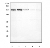 Western blot testing of 1) human K562, 2) human HepG2, 3) human SH-SY5Y, 4) rat brain and 5) mouse brain tissue lysate with HDAC6 antibody. Expected molecular weight 130~160 kDa.