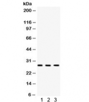 Western blot testing of 1) rat heart, 2) rat brain and 3) human A549 lysate with DKK2 antibody. Expected molecular weight: 28-35 kDa.