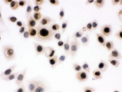 ICC testing of human SMMC-7721 cells with Daxx antibody.