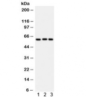 Western blot testing of 1) rat liver, 2) human placenta, 3) A549 lysate with Heparanase 1 antibody. Predicted molecular weight: 61 kDa (isoform 1), ~53 kDa (isoform 2/3), ~43 kDa (isoform 4).