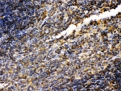 IHC-P: TGM2 antibody testing of mouse spleen tissue