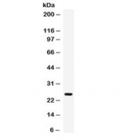 Western blot testing of human placenta lysate with Elafin antibody. Predicted molecular weight ~12 kDa (pre-form), observed here at ~25 kDa.