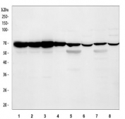 Western blot testing of 1) human 293T, 2) human A549, 3) human HeLa, 4) human MCF7, 5) rat brain, 6) rat lung, 7) mouse brain and 8) mouse lung tissue lysate with CCT3 antibody. Expected molecular weight ~61 kDa.