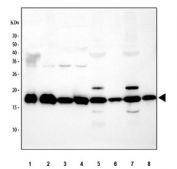 Western blot testing of 1) human Raji, 2) HUVEC, 3) human HepG2, 4) human HeLa, 5) rat skeletal muscle, 6) rat liver, 7) mouse skeletal muscle and 8) mouse liver tissue lysate with Cofilin 2 antibody. Predicted molecular weight: ~19 kDa.