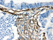 IHC testing of FFPE human intestine with Caldesmon antibody. HIER: Boil the paraffin sections in pH8 EDTA buffer for 20 minutes and allow to cool prior to testing.