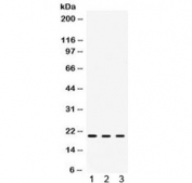 Western blot testing of 1) rat spleen, 2) mouse eye and 3) human SMMC-7721 lysate with Alpha A Crystallin antibody. Expected molecular weight: 20-23 kDa.
