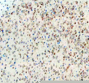 IHC staining of FFPE rat brain tissue with CGRP antibody, HRP-secondary and DAB substrate. HIER: boil tissue sections in pH8 EDTA for 20 min and allow to cool before testing.