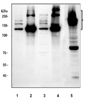 Western blot testing of 1) rat lung, 2) rat skin, 2) mouse lung, 4) mouse skin and 5) mouse NIH 3T3 cell lysate with Collagen I antibody. Expected molecular weight: 140-210 kDa (precusor), 70-90 kDa (mature).