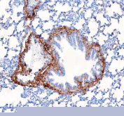 IHC staining of FFPE rat lung tissue with Collagen I antibody, HRP-secondary and DAB substrate. HIER: boil tissue sections in pH8 EDTA for 20 min and allow to cool before testing.