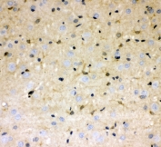 IHC staining of FFPE rat brain with DDAH1 antibody at 1ug/ml. HIER: boil tissue sections in pH6, 10mM citrate buffer, for 10-20 min followed by cooling at RT for 20 min.