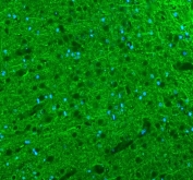 Immunofluorescent staining of FFPE rat brain tissue with Alpha Internexin antibody (green) and DAPI nuclear stain (blue). HIER: steam section in pH8 EDTA buffer for 20 min.