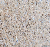 IHC staining of FFPE rat brain tissue with Alpha Internexin antibody. HIER: boil tissue sections in pH8 EDTA for 20 min and allow to cool before testing.