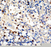 IHC staining of FFPE human spleen tissue with Platelet factor 4 antibody, HRP-secondary and DAB substrate. HIER: boil tissue sections in pH8 EDTA for 20 min and allow to cool before testing.