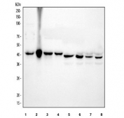 Western blot testing of 1) rat kidney, 2) rat liver and 3) human HepG2 lysate with AMACR antibody at 0.5ug/ml. Predicted molecular weight ~43 kDa.