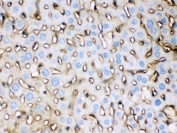 IHC testing of FFPE mouse liver with APOE antibody at 1ug/ml. HIER: steam in pH6 citrate buffer and allow to cool prior to staining.