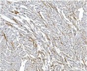 IHC staining of FFPE rat heart with ARF6 antibody. HIER: boil tissue sections in pH8 EDTA for 20 min and allow to cool before testing.