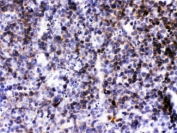 IHC testing of FFPE mouse lymph tissue with BCA1 antibody. HIER: steam sections in pH6 citrate buffer for 20 min.