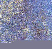 IHC staining of FFPE mouse spleen tissue with BCA1 antibody, HRP-secondary and DAB substrate. HIER: boil tissue sections in pH8 EDTA for 20 min and allow to cool before testing.