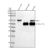 Immunoprecipitation of ABCE1 protein from 500ug of human A431 whole cell lysate with 2ug of ABCE1 antibody.