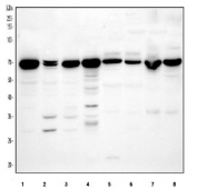 Western blot testing of 1) human HepG2, 2) human A431, 3) human U-2 OS, 4) human Jurkat, 5) rat brain, 6) mouse brain, 7) mouse 4T1 and 8) mouse NIH 3T3 cell lysate with ABCE1 antibody at 0.5ug/ml. Predicted molecular weight ~67 kDa.