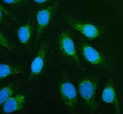 Immunofluorescent staining of FFPE human U-2 OS cells with ACADVL antibody (green) and DAPI nuclear stain (blue). HIER: steam section in pH6 citrate buffer for 20 min.
