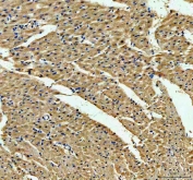 IHC staining of FFPE rat heart tissue with ACADVL antibody. HIER: boil tissue sections in pH8 EDTA for 20 min and allow to cool before testing.