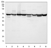 Western blot testing of 1) human HeLa, 2) human SiHa, 3) human A549, 4) human U-251, 5) rat liver, 6) rat heart, 7) mouse liver and 8) mouse heart tissue lysate with ACADVL antibody. Predicted molecular weight: 68-70 kDa.