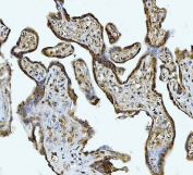 IHC testing of FFPE human placental tissue with ATP Citrate Lyase antibody at 2ug/ml. HIER: steam sections in pH8 EDTA for 20 min.