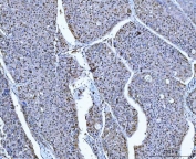 Flow cytometry testing of human U-87 MG cells with ATP Citrate Lyase antibody at 1ug/10^6 cells (blocked with goat sera); Red=cells alone, Green=isotype control, Blue=ATP Citrate Lyase antibody.