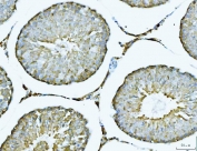IHC testing of FFPE rat testis tissue with ATP Citrate Lyase antibody at 2ug/ml. HIER: steam sections in pH8 EDTA for 20 min.