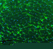 Immunofluorescent staining of FFPE mouse skeletal muscle tissue with ACTN3 antibody (green) and DAPI nuclear stain (blue). HIER: steam section in pH8 EDTA buffer for 20 min.