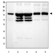 Western blot testing of 1) human HT1080, 2) rat skeletal muscle, 3) rat skeletal muscle, 4) mouse skeletal muscle and 5) mouse skeletal muscle tissue lysate with ACTN3 antibody at 0.5ug/ml. Predicted molecular weight ~103 kDa.