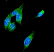 Immunofluorescent staining of FFPE human U-2 OS cells with Alcohol dehydrogenase antibody (green) and DAPI nuclear stain (blue). HIER: steam section in pH6 citrate buffer for 20 min.