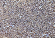 IHC testing of FFPE rat liver tissue with Alcohol dehydrogenase antibody. HIER: steam sections in pH8 EDTA buffer for 20 min.