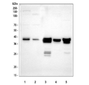 Western blot testing of 1) human HepG2, 2) human HeLa, 3) rat liver, 4) rat RH35 and 5) mouse liver tissue lysate with ADH4 antibody at 0.5ug/ml. Predicted molecular weight ~40 kDa.