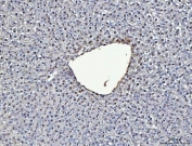 IHC staining of FFPE rat liver tissue with ADK antibody. HIER: boil tissue sections in pH8 EDTA for 20 min and allow to cool before testing.