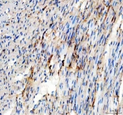 IHC staining of FFPE rat heart tissue with AK1 antibody. HIER: boil tissue sections in pH8 EDTA for 20 min and allow to cool before testing.