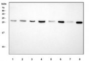 Western blot testing of 1) human HeLa, 2) human HL60, 3) human 293T, 4) human HepG2, 5) rat heart, 6) rat liver, 7) mouse heart and 8) mouse liver tissue lysate with AK2 antibody. Predicted molecular weight ~26 kDa.