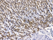 IHC testing of FFPE rat adrenal gland with AKR1B1 antibody at 1ug/ml. HIER: steam sections in pH6 citrate buffer for 20 min.