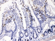 IHC testing of FFPE rat intestine with AKR1B1 antibody at 1ug/ml. HIER: steam sections in pH6 citrate buffer for 20 min.