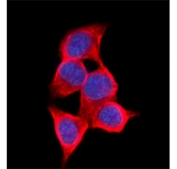 Immunofluorescent staining of FFPE human HepG2 cells with AKR1C1/2 antibody (green) and DAPI nuclear stain (blue). HIER: steam section in pH6 citrate buffer for 20 min.