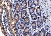 IHC staining of FFPE rat colon with ALDH1B1 antibody. HIER: boil tissue sections in pH8 EDTA for 20 min and allow to cool before testing.